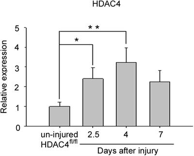 HDAC4 Regulates Skeletal Muscle Regeneration via Soluble Factors